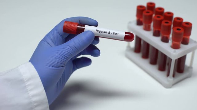 Hepatitis B, doctor showing blood sample in tube, lab research, health checkup
