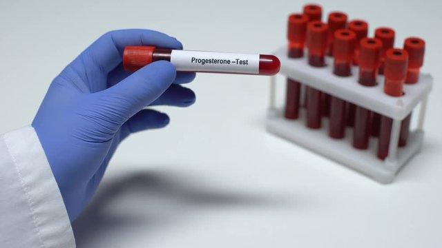 Progesterone, doctor showing blood sample in tube, lab research, health checkup