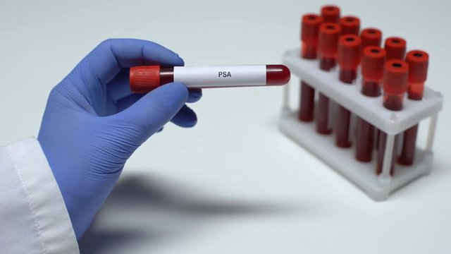 PSA test, doctor showing blood sample in tube, lab research, health checkup