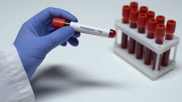 Aldosterone, doctor showing blood sample in tube, lab research, health checkup