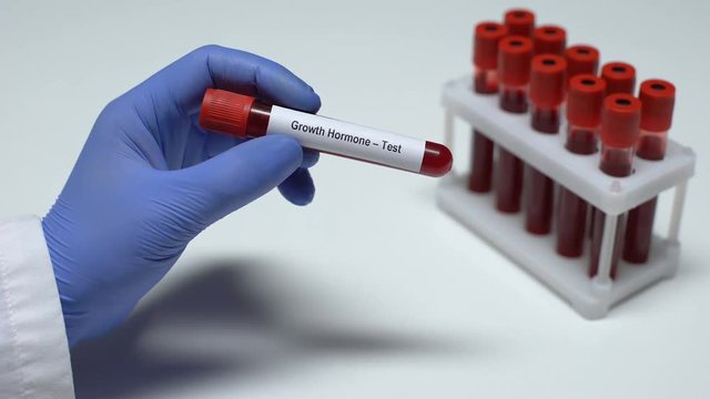 Growth Hormone, doctor shows blood sample in tube, lab research, health checkup
