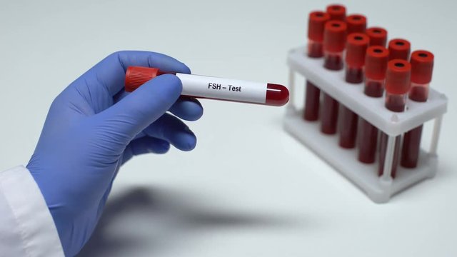 FSH Test, doctor showing blood sample in tube, lab research, health checkup