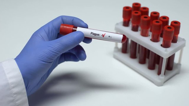 Negative Plague test, doctor showing blood sample in tube, health checkup