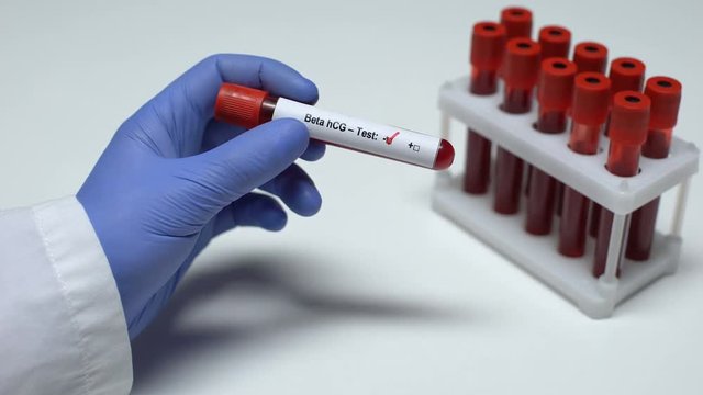 Negative Beta hCG test, doctor showing blood sample in tube, health checkup