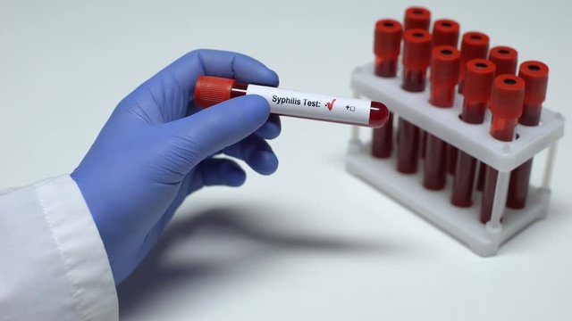 Negative Syphilis test, doctor showing blood sample in tube, health checkup