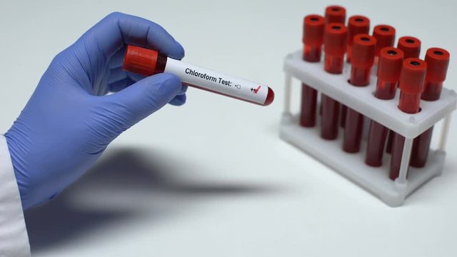 Positive Chloroform test, doctor showing blood sample in tube, health checkup