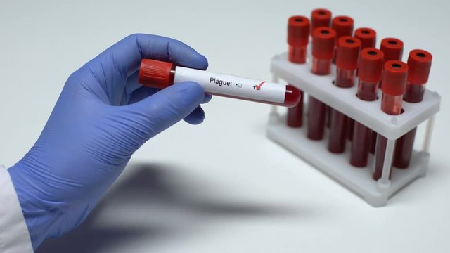 Positive Plague test, doctor showing blood sample, lab research, health checkup