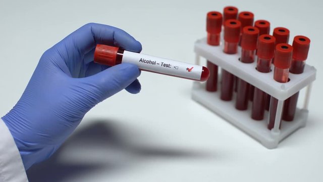 Positive Alcohol test, doctor showing blood sample, lab research, health checkup