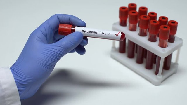Positive Mycoplasma test, doctor showing blood sample in tube, health checkup