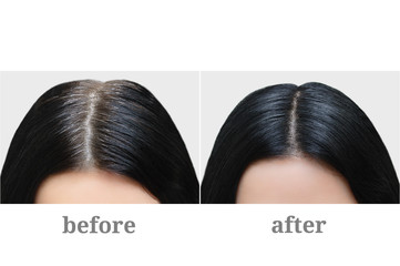 Head of a girl with black gray hair. Hair coloring. Before and after.
