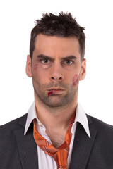 Close up of a businessman with bloody lip, beaten and bruised