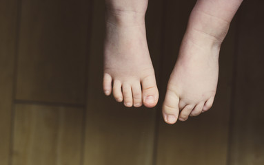 Fototapeta premium Child's Bare Feet. Orthopedics and children health care concept