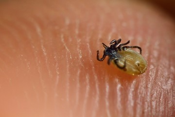 Tick on skin