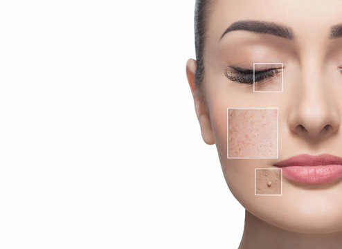 Portrait of a beautiful woman on a white background, on the face are visible areas of problem skin - wrinkles and freckles. Cosmetology concept.