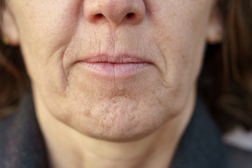 Close up detail of the chin of a middle-aged woman - obrazy, fototapety, plakaty