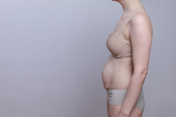 A woman with a figure after giving birth. Stretch marks on the belly. side view