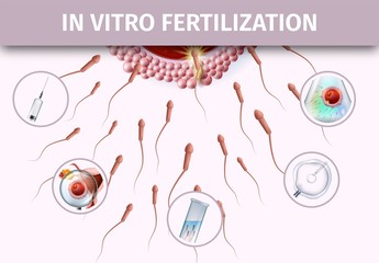 Artificial Insemination Infographic Aid Banner