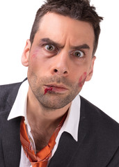 Close up of a businessman with bloody lip, beaten and bruised