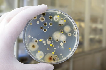 Colonies of different bacteria and mold fungi grown on Petri dish with nutrient agar, close-up view. Hand in white glove holding plate with nutrient medium in research laboratory © Dr_Microbe