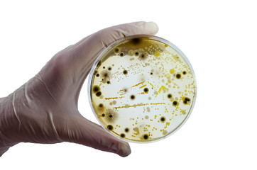 Colonies of different bacteria and mold fungi grown on Petri dish with nutrient agar, close-up view. Hand in white glove holding plate with nutrient medium isolated on white background