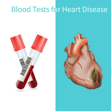 Blood tests for heart disease. Vector medical illustration. White background.