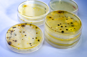 Colonies of different bacteria and mold fungi grown on Petri dish with nutrient agar, close-up view. Microbiology background