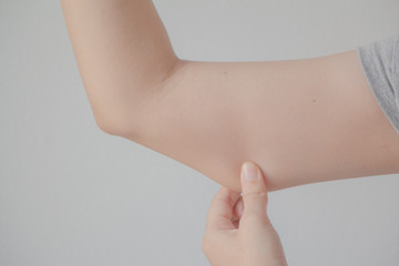 Woman checking fat upper arm.Healthcare. 