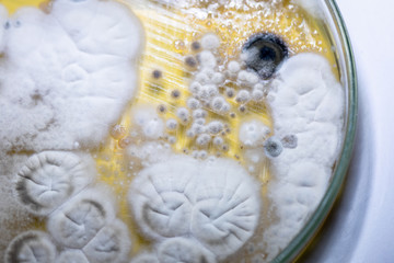 characteristic of Actinomyces, Bacteria, yeast and Mold on selective media from soil samples for study in laboratory microbiology.