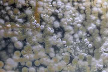 Obraz na płótnie Canvas characteristic of Actinomyces, Bacteria, yeast and Mold on selective media from soil samples for study in laboratory microbiology.