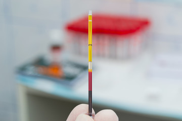 scientist holding in his hand a centrifuged blood sample with hemolysis