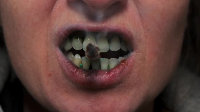 man holds a smoldering cigarette in his terrible teeth and releases smoke. Close-up.