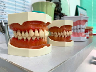 Teeth and jaw model on white table in the dentist clinic.