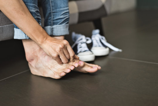 athlete's foot of woman