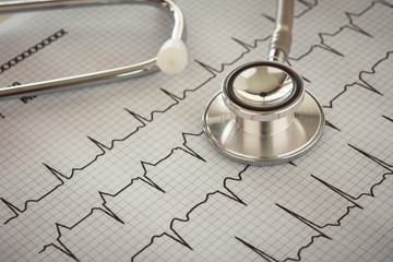Stethoscope on cardiogram sheet of cardiology patient. Cardiologist and medical concept