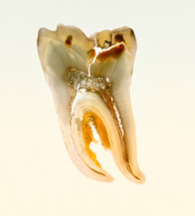 Zahnschnitt im Durchlicht