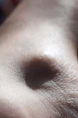Naklejka premium Painful arthritis on the foot of a white woman.
