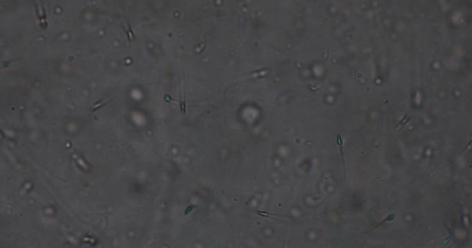 Biosph&auml;re im Micro Universum
