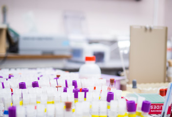 Lavender cap of test tubes and clotted blood tubes in the rack (Spot selection)