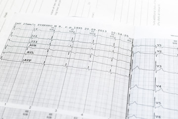 medical ecg analysis on paper concept, heart beat