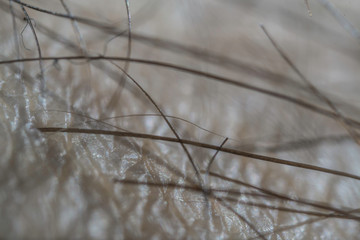 Skin Texture