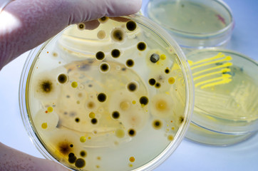 Colonies of different bacteria and mold fungi grown on Petri dish with nutrient agar, close-up view. Hand in white glove holding plate with microbes