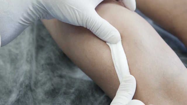 Close-up hands of phlebologist in gloves put bandage on his leg after sclerotherapy procedure