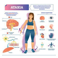 Ataxia vector illustration. Labeled medical movement brain disorder scheme.