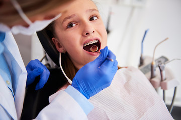 Part of orthodontist examining child's teeth in dentist's office - obrazy, fototapety, plakaty