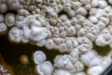 Colony characteristic of Actinomyces, Bacteria, yeast and Mold on selective media from soil samples for study in laboratory microbiology.