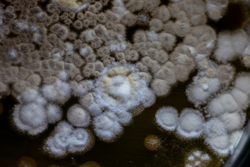 Colony characteristic of Actinomyces, Bacteria, yeast and Mold on selective media from soil samples for study in laboratory microbiology.