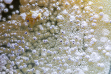 Colony characteristic of Actinomyces, Bacteria, yeast and Mold on selective media from soil samples for study in laboratory microbiology.