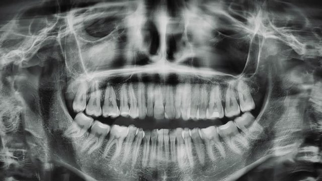 Smiling x-ray jaw . Animation of attempting smile roentgen of teeth.