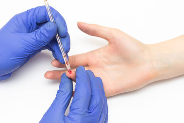 The doctor does a general blood test to the patient of the girl for a study of platelet indicators...