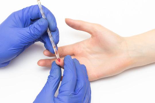The doctor does a general blood test to the patient of the girl for a study of platelet indicators and soe, close-up, hormones